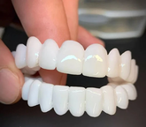 (PAGUE 1, LEVE 5) Lente Dental White® - Kit Superior + Inferior (TOTALMENTE AJUSTÁVEL A TODAS ARCADAS DENTÁRIAS)